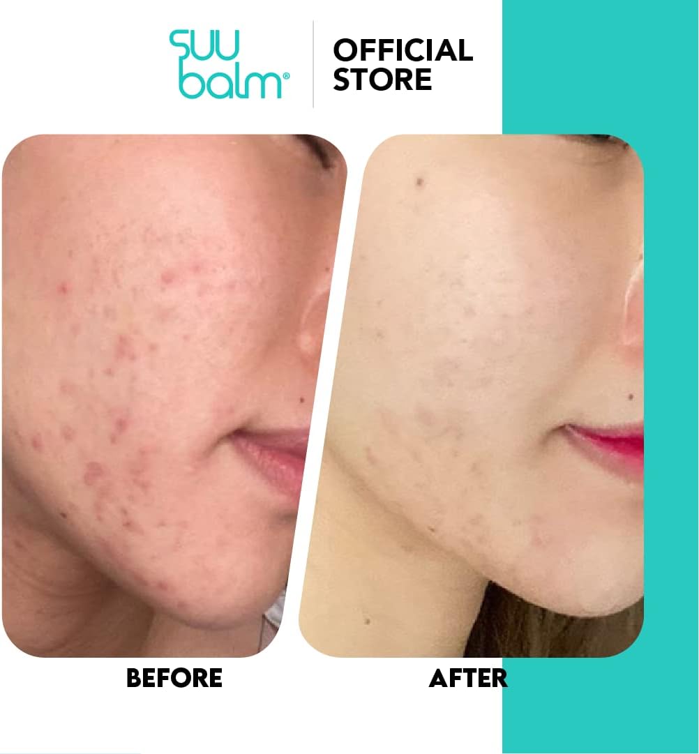 Nettoyant Visage Suu Balm® - Doux et Hydratant