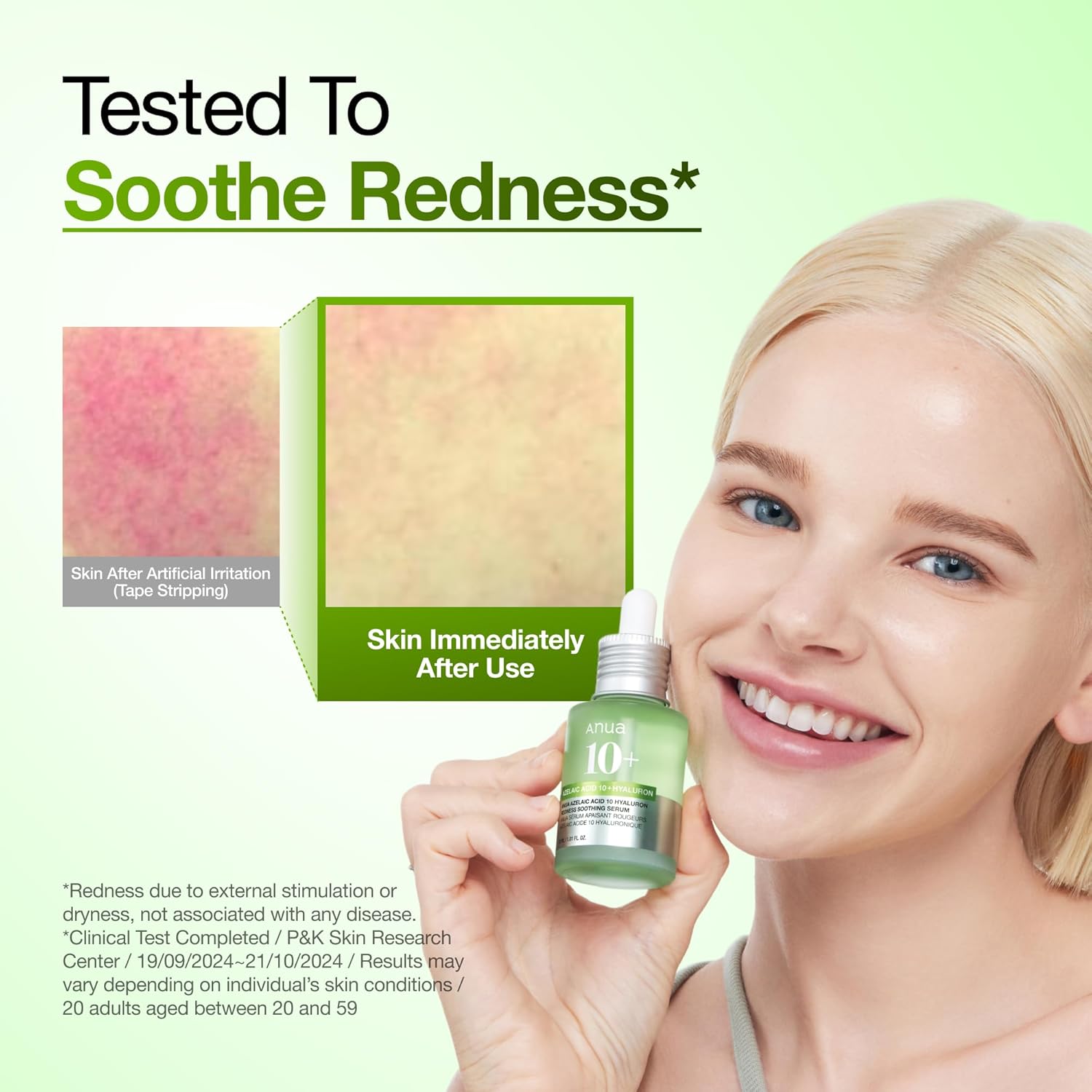 Sérum Apaisant Anua à l'Acide Azélaïque 10 et à l'Acide Hyaluronique, Sérum Visage pour Peaux Sensibles et à Imperfections, Soin Anti-Imperfections Léger et Hydratant, Acide Hyaluronique, Soin Coréen, 30 ml.