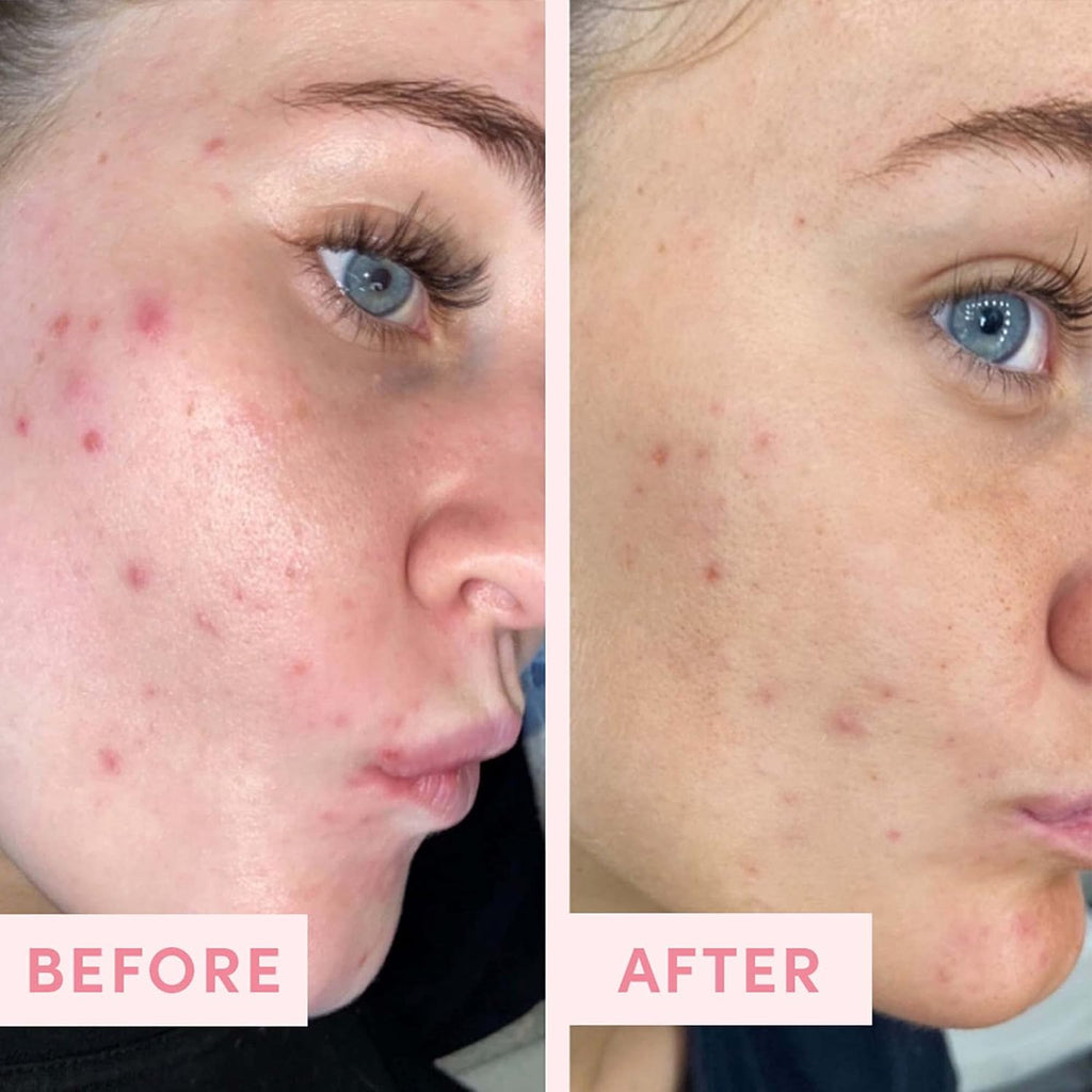 Sand & Sky Gommage exfoliant visage à l'argile rose australienne avec AHA et poudre de perles - Exfoliant doux physique et chimique pour une peau lisse, réduit la texture de la peau