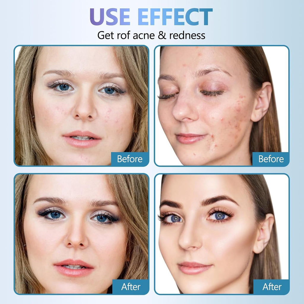 12 masques faciaux coréens, masque en feuille de collagène avec acide salicylique, hydratant et apaisant pour une peau lisse et saine (masque en feuille hydratant et apaisant)