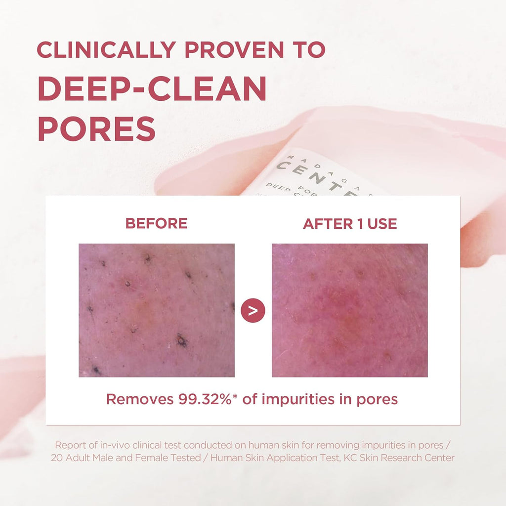 SKIN1004 Poremizing Deep Cleansing Foam, 125ml, Makeup Remover, Korean Face Cleanser with Himalayan Pink Salt & Madagascar Centella Asiatica, Gentle Facial Cleanser for Pore Care, Daily Korean Skincare
