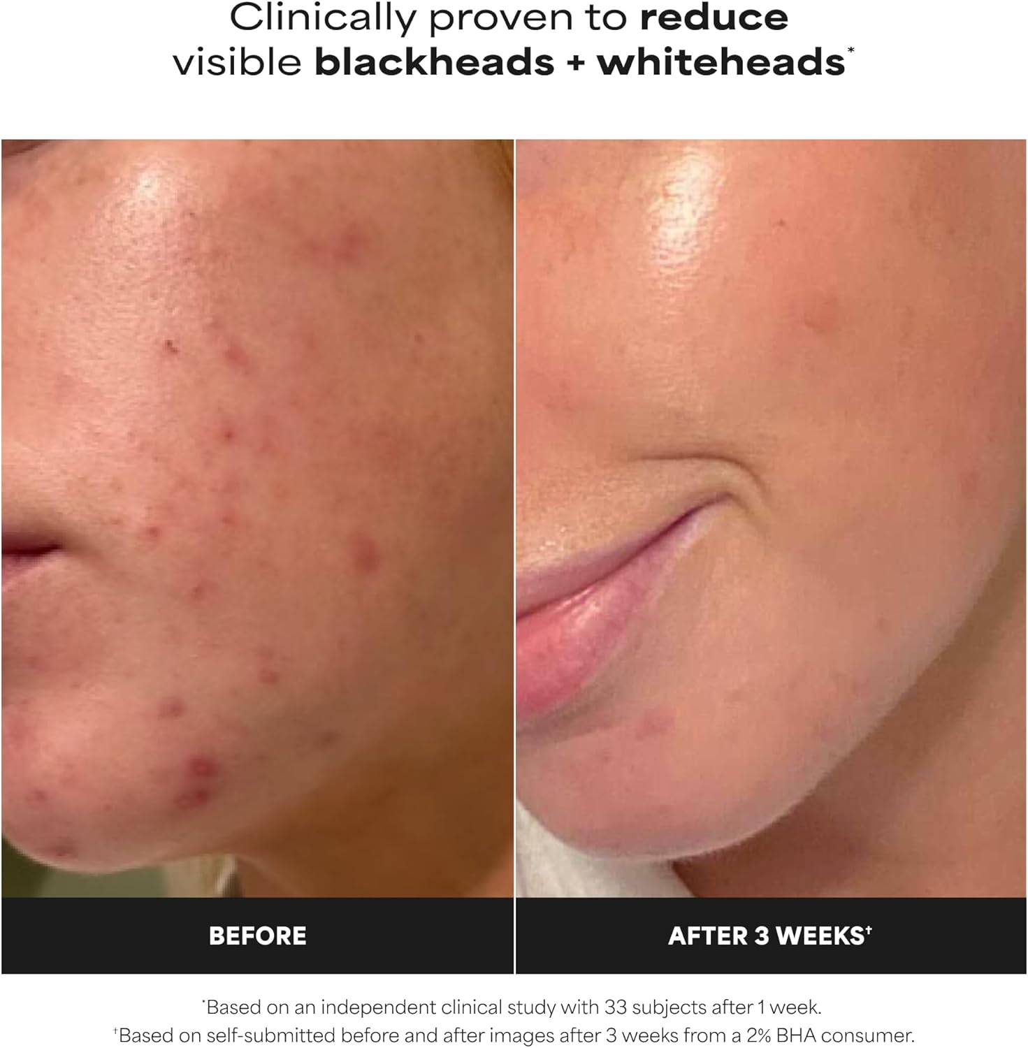 Exfoliant liquide Paula's Choice Skin Perfecting 2% BHA à l'acide salicylique, exfoliant doux pour le visage contre les points noirs, les pores dilatés, les rides et ridules, format voyage, flacon de 30 ml