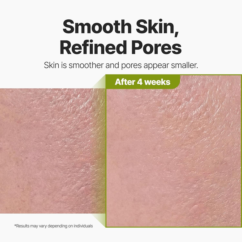 P.CALM Holy Basil Bubble Deep Mask 90g Masque coréen purifiant pour les pores, à rincer, pour le soin des points noirs et du sébum des peaux sensibles