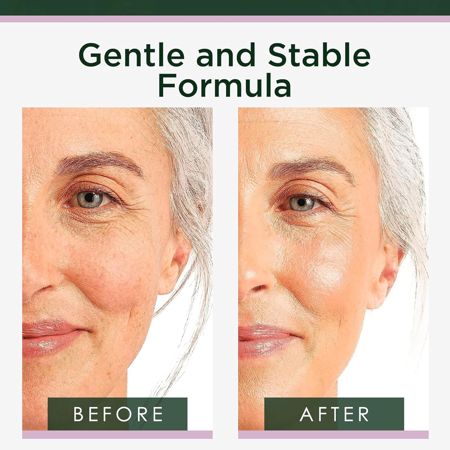 Sérum au Rétinol pour le Visage et la Peau, Format Double (60 ml), Concentration Clinique