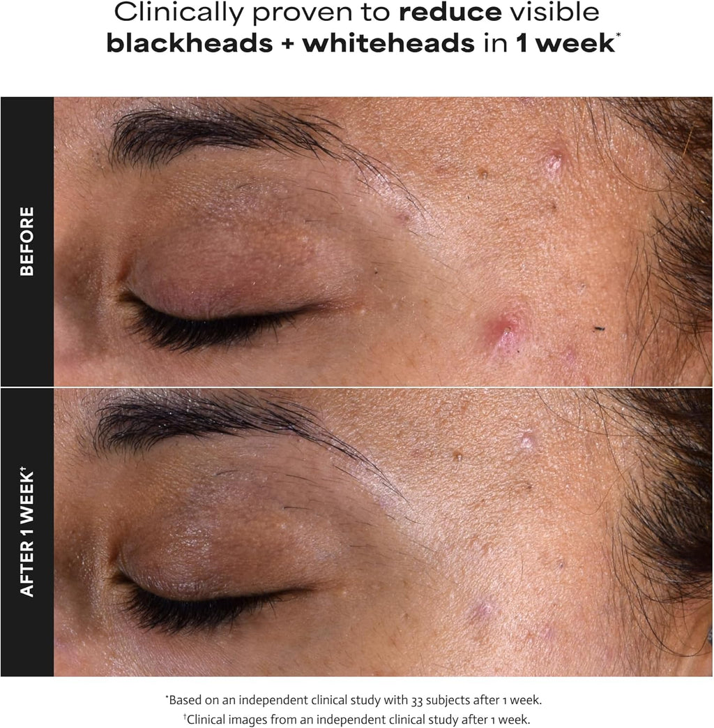 Exfoliant liquide Paula's Choice Skin Perfecting 2% BHA à l'acide salicylique, exfoliant doux pour le visage contre les points noirs, les pores dilatés, les rides et ridules, format voyage, flacon de 30 ml